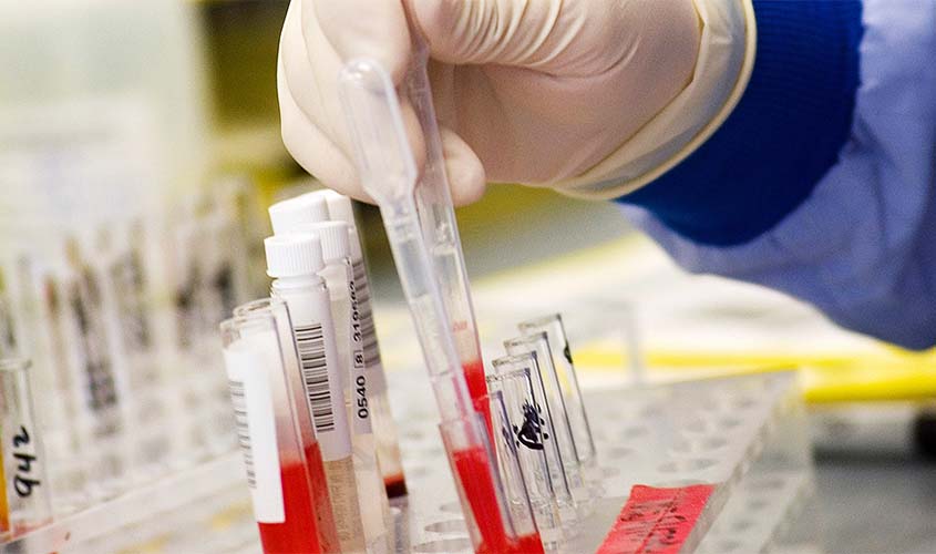 Brasil é primeiro país a aprovar antecipação de tratamento para câncer no sangue