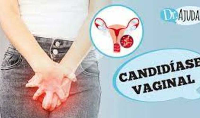 O que é candidíase vaginal?