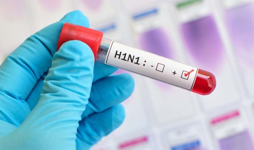 Casos de H1N1 crescem entre adultos; diagnósticos de covid-19 caem