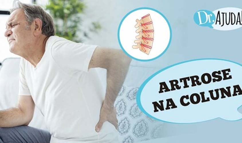 O que é artrose na coluna? Quando suspeitar e qual o tratamento?