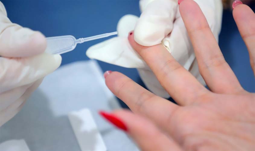 Porto Velho registra queda de HIV e reforça prevenção