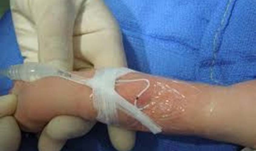 Rondônia registra 45 casos de saúde em recém-nascidos