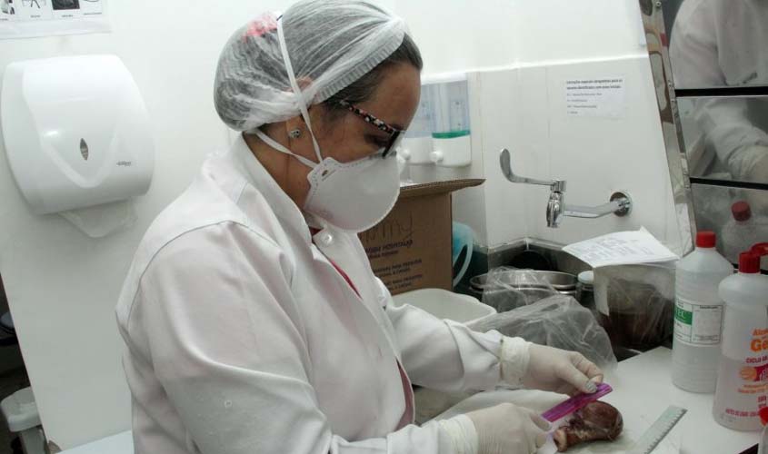 Laboratório de Patologia prioriza casos suspeitos de câncer e dá agilidade aos diagnósticos em Rondônia