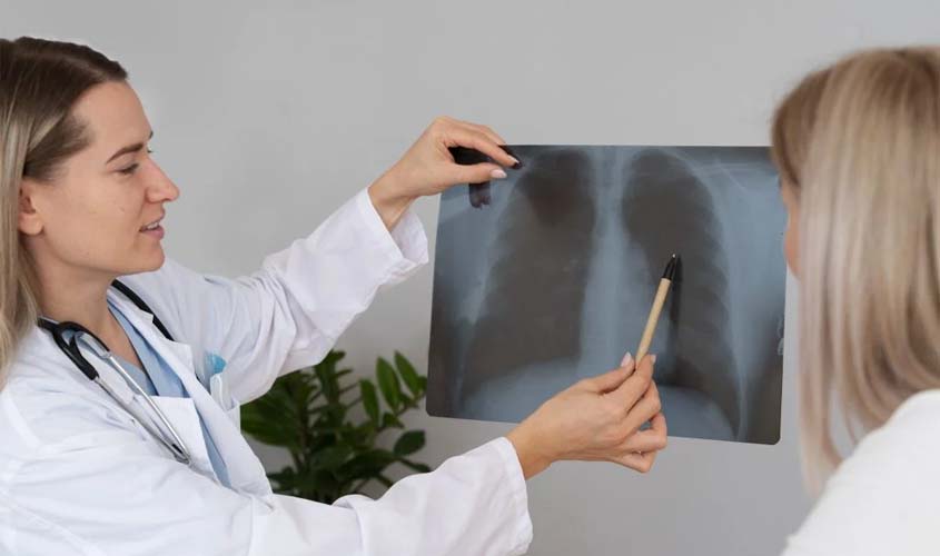 Câncer de pulmão: diagnóstico tardio reduz cura
