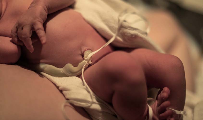 Saiba como o cordão umbilical de recém-nascidos pode salvar vidas
