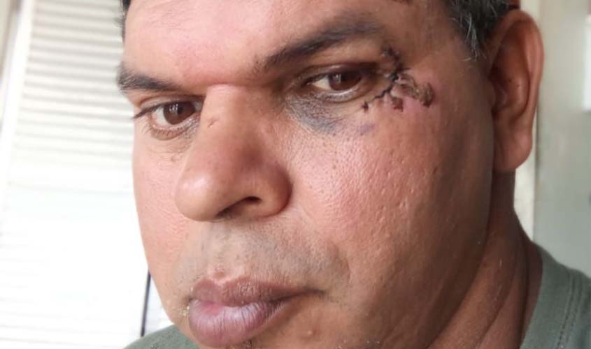 Jailton Delogo denuncia obstáculos em calçadas para PCDs