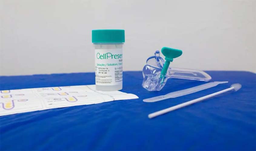 Guia orienta sobre rastreamento do câncer do colo do útero