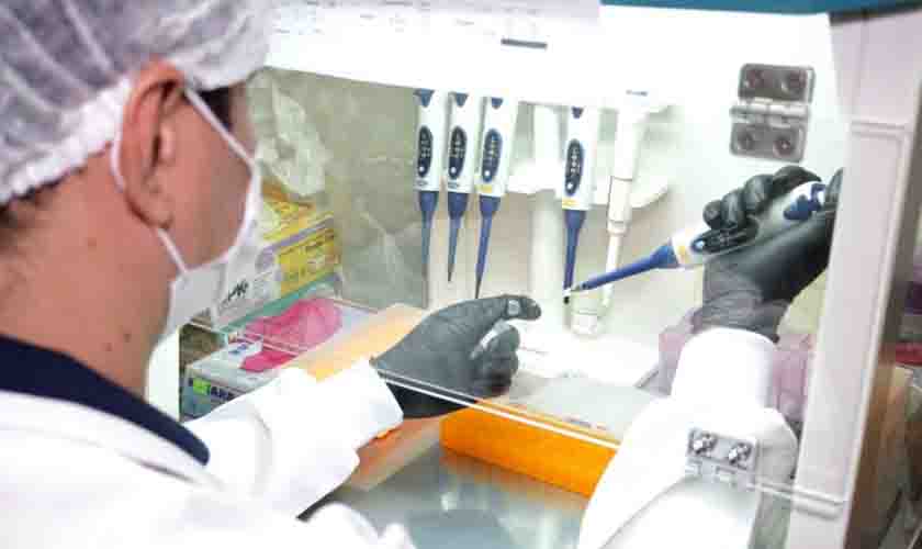 Laboratório Central de Saúde Pública de Rondônia implanta diagnóstico do Poliomavírus BK