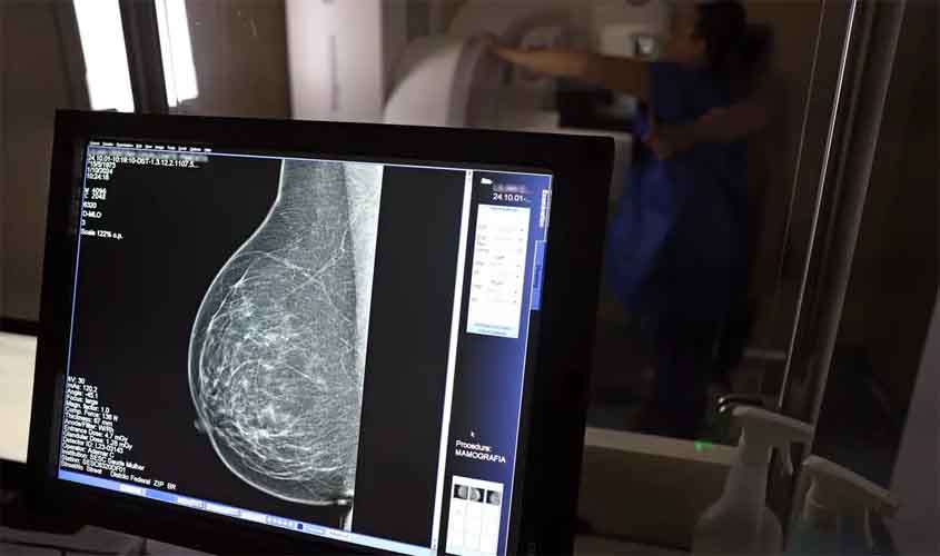Câncer de mama: uma em cada três pacientes tem menos de 50 anos