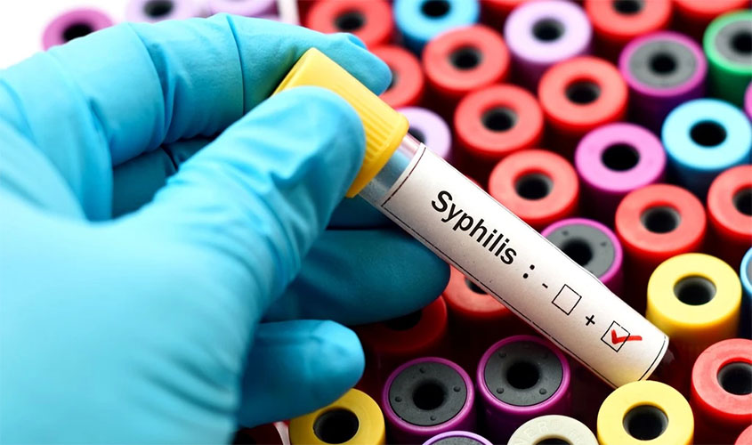 Casos de sífilis quase dobram em Porto Velho, aponta Ministério da Saúde