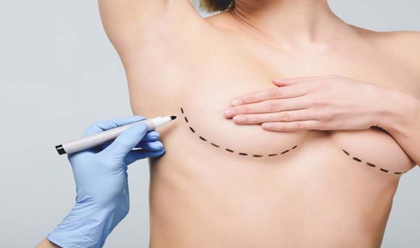 Mamoplastia no Futuro: Avanços na Cirurgia Plástica Mamária