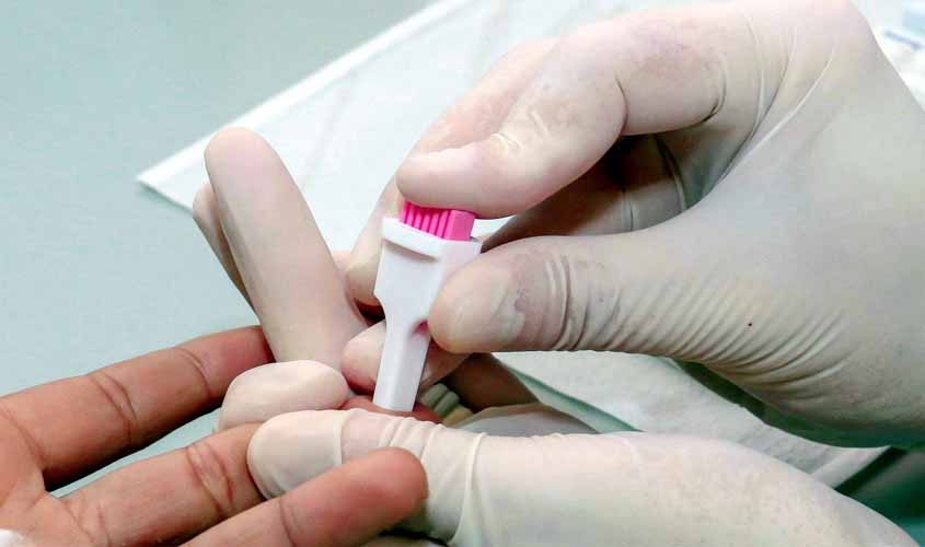 Agevisa orienta para uso de novo método de prevenção ao HIV