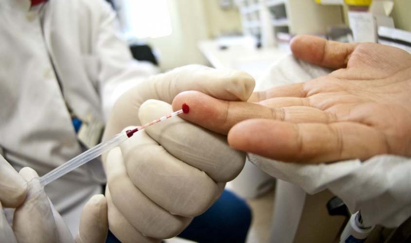 Saúde disponibiliza autoteste de HIV em pesquisa inédita na cidade de São Paulo