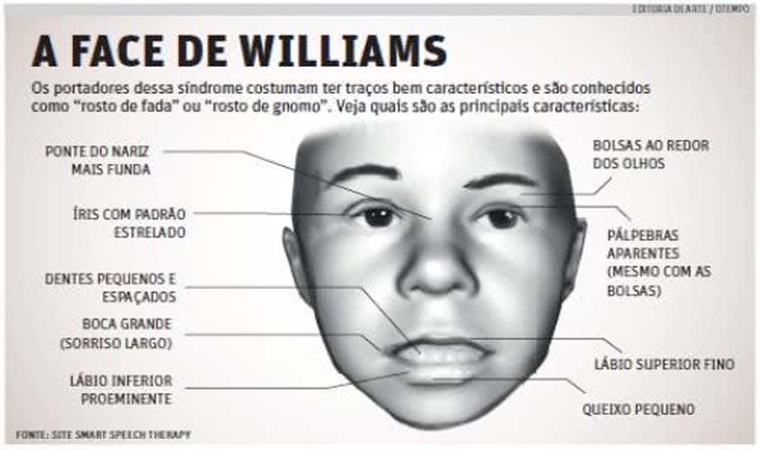 Conhece a Síndrome de Williams?