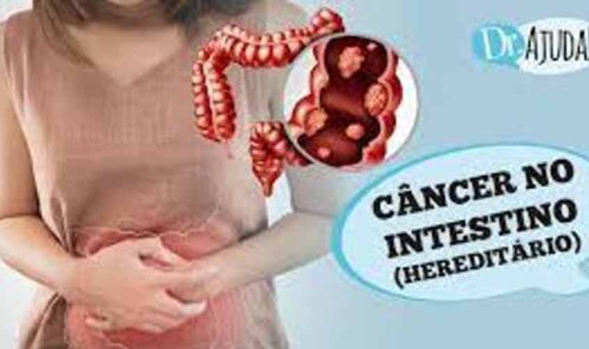 Câncer de intestino pode ser hereditário?