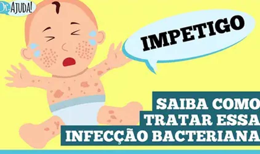 Impetigo: infecção de pele comum em crianças