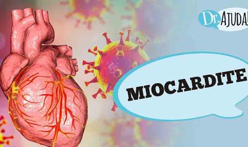 O que é miocardite? Quais são os sintomas e as causas?