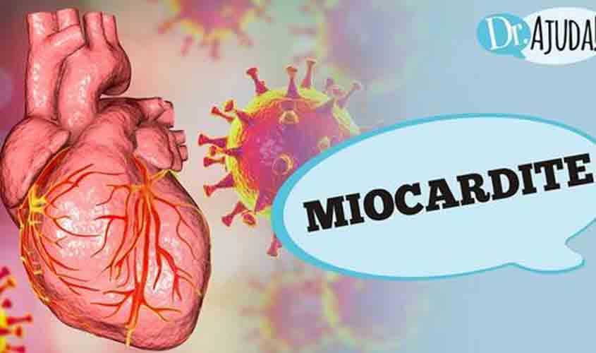 O que é miocardite? Quais são os sintomas e as causas?