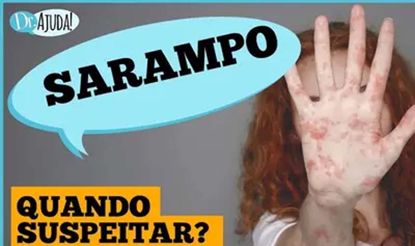Sarampo: quando suspeitar