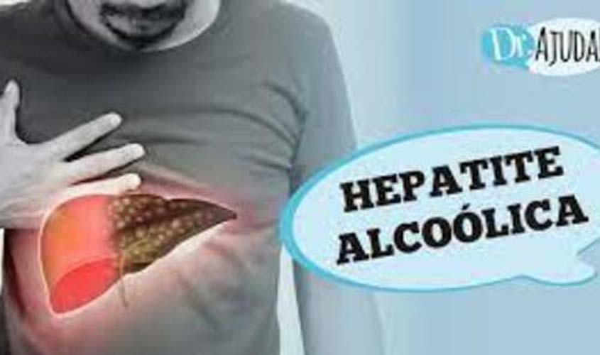 HEPATITE ALCOÓLICA E CIRROSE: sintomas, diagnóstico e tratamento