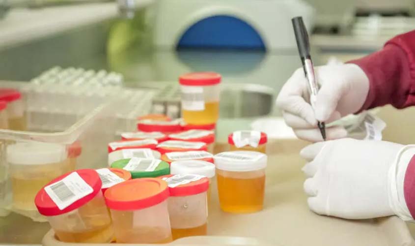 Rondônia tem 447 laboratórios e 4 falhas em análises, aponta ANVISA