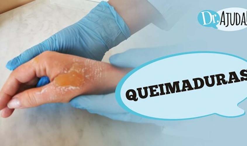Queimaduras: como avaliar o grau, tratar e evitar?
