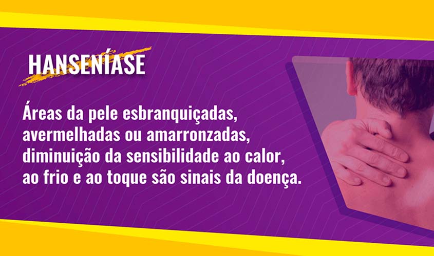 Rondônia é o terceiro da região Norte com o maior número de casos de hanseníase