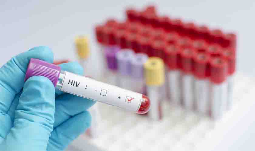 Empresa é condenada por exigir teste de HIV para contratação de garçom