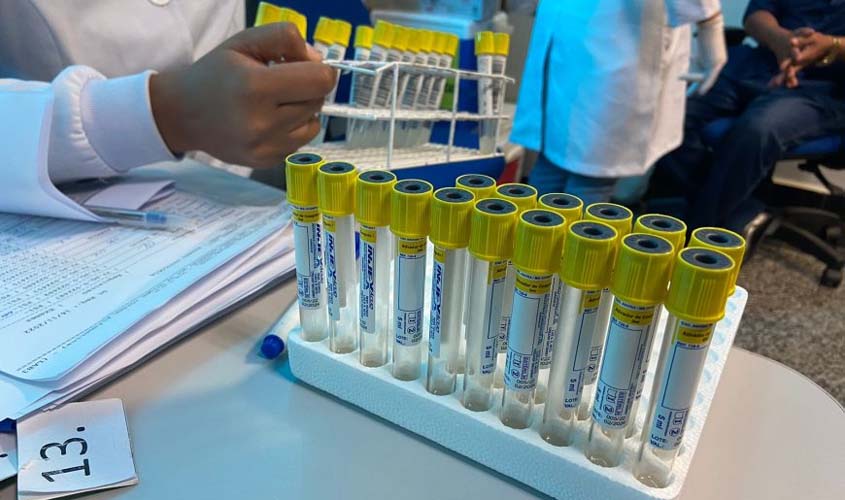 Exame de sangue Antígeno Prostático Específico é oferecido aos servidores públicos durante o Novembro Azul
