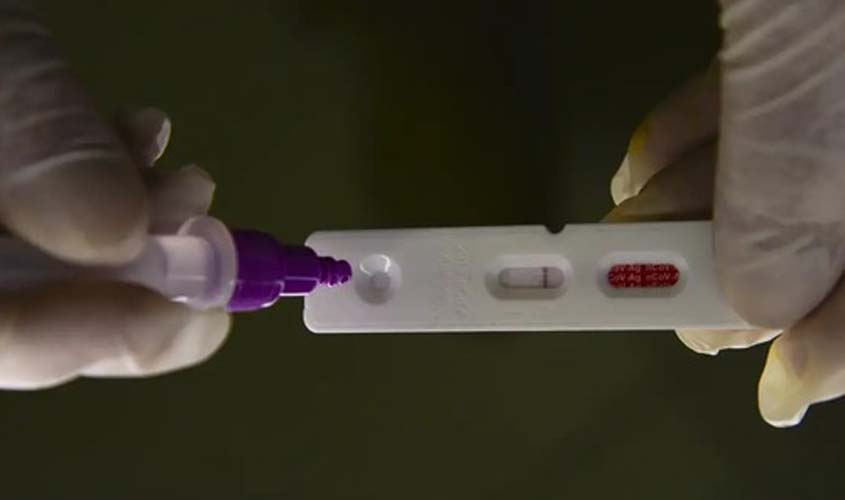 Brasil registra 1.127 mortes em decorrência da Covid-19 em 2024