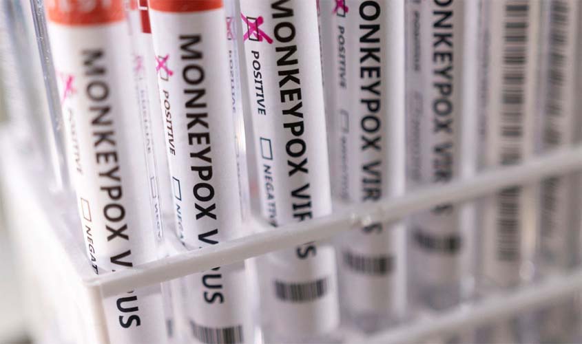 Ministério da Saúde confirma 8º caso de varíola dos macacos no país