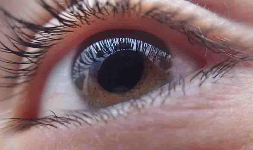 Catarata: cinco dicas para identificar primeiros sinais de perda da visão