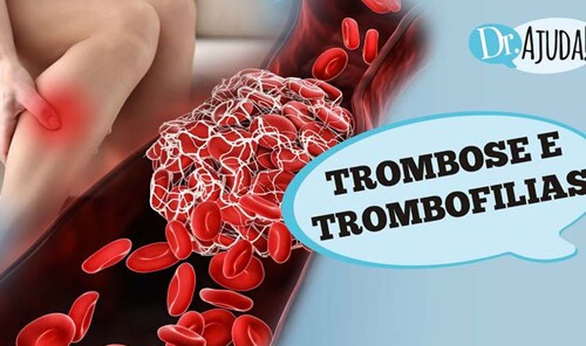 TROMBOSE E TROMBOFILIAS: O que são? Grupos de risco e tratamentos