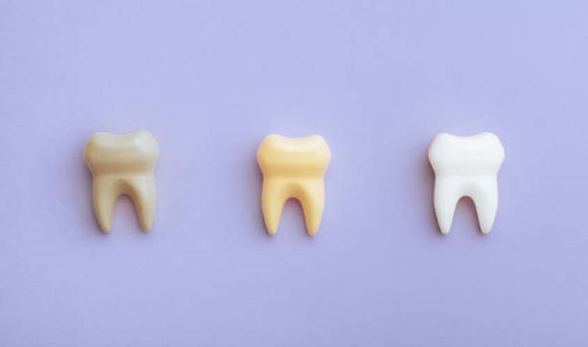 Mitos e verdades sobre alimentos que mancham os dentes