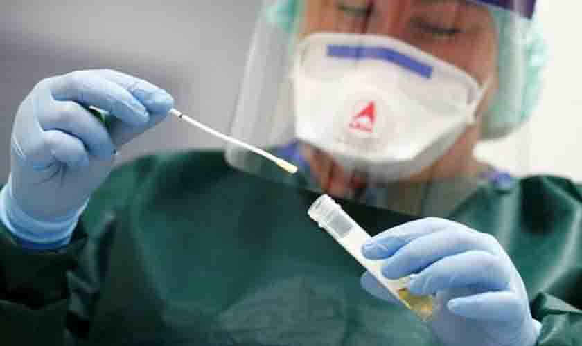 Planos de saúde são obrigados a cobrir testes de detecção da Covid-19