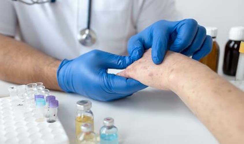 Primeiro teste para diagnóstico da Monkeypox no Brasil é aprovado pela Anvisa