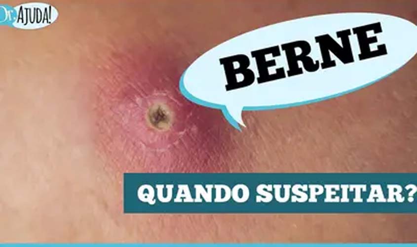 Berne: parece uma espinha, mas pode ser uma larva na pele