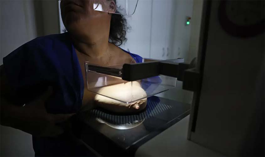 Mamografia deve ser coberta por planos, diz ANS