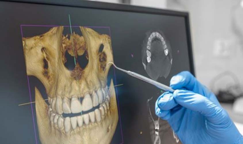 Exames Odontológicos São Cruciais Para A Saúde Dental