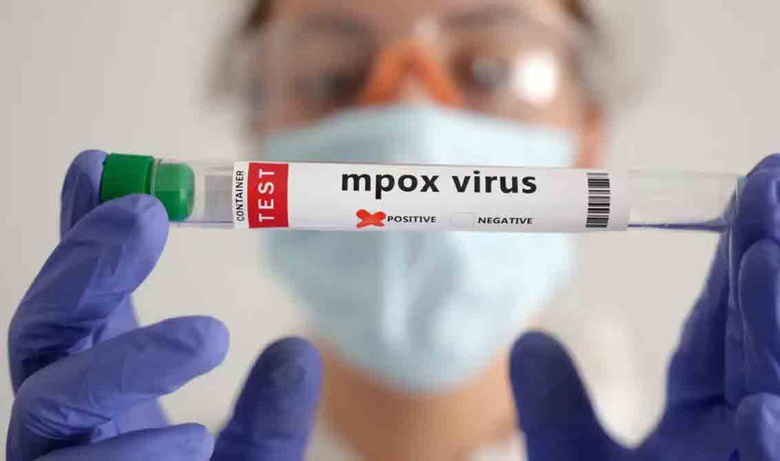 OMS estima custo de US$ 135 milhões em 6 meses para conter mpox