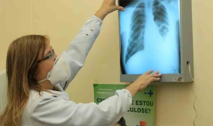 TUBERCULOSE: Coordenadora do Ministério da Saúde tira dúvidas sobre doença