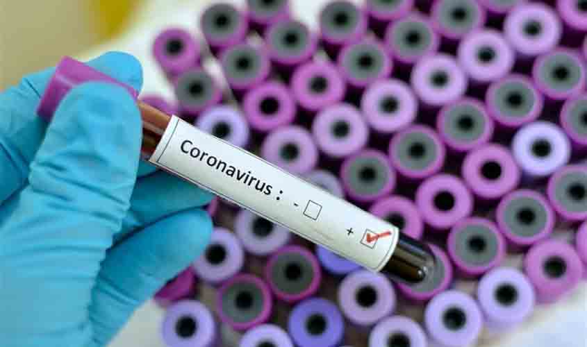 Porto Velho recebe estudo para avaliar a incidência de infecção do coronavírus na população brasileira