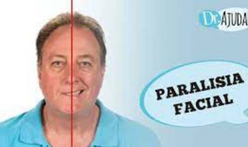 Paralisia facial: causas e tratamento