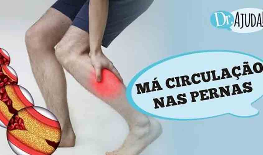 Dr. Ajuda: o que causa dor e má circulação nas pernas?