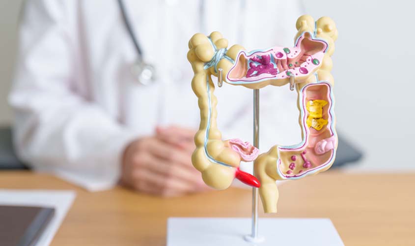 Fábrica de alimentos é condenada por demitir funcionário com doença de Crohn