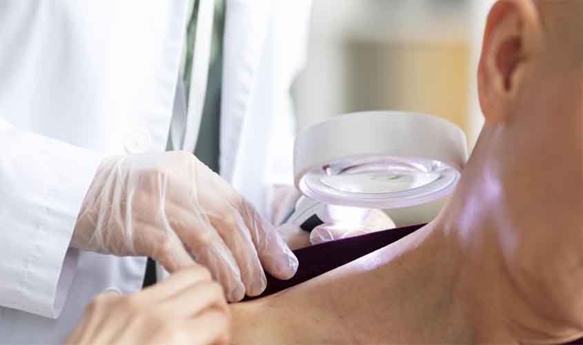 Você sabe o que é carcinoma basocelular?