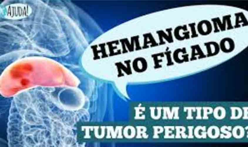 Dr. Ajuda: O que são os hemangiomas (nódulos) no fígado?