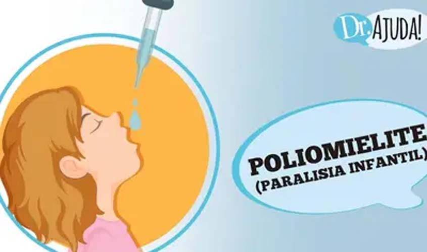 Poliomelita: paralisia infantil