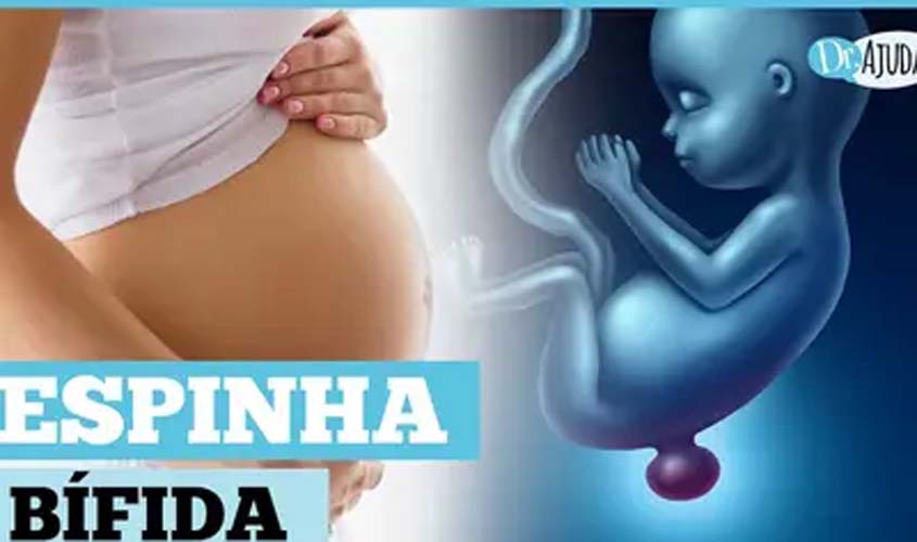 O que é e como prevenir a mielomeningocele?