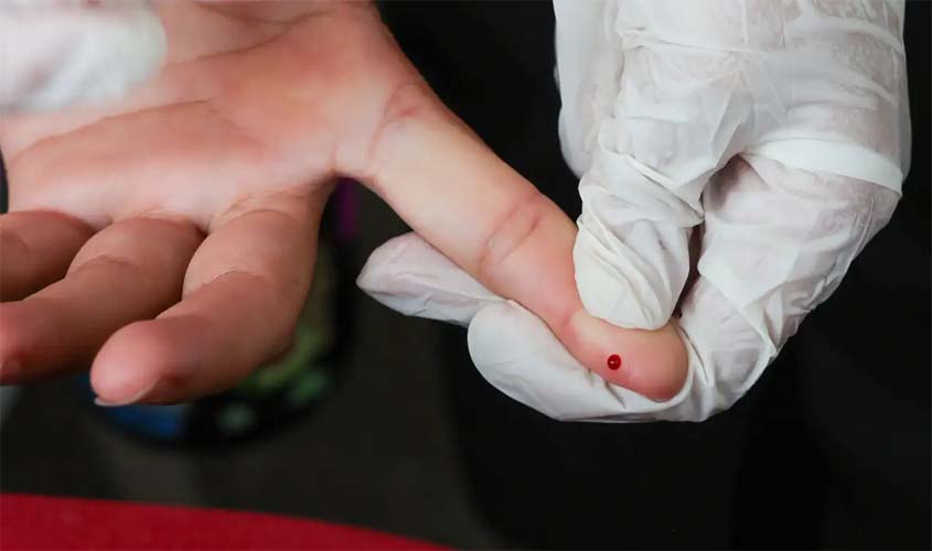 Meta de redução da hepatite B é alcançada no Brasil